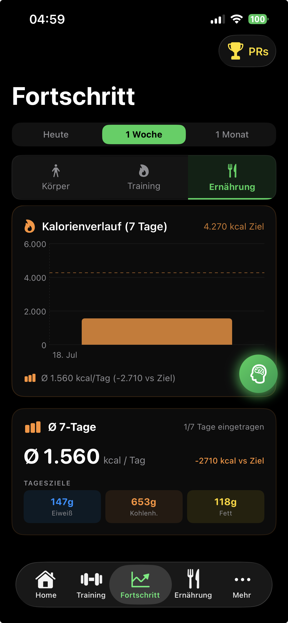 Gym Assist Fortschritt