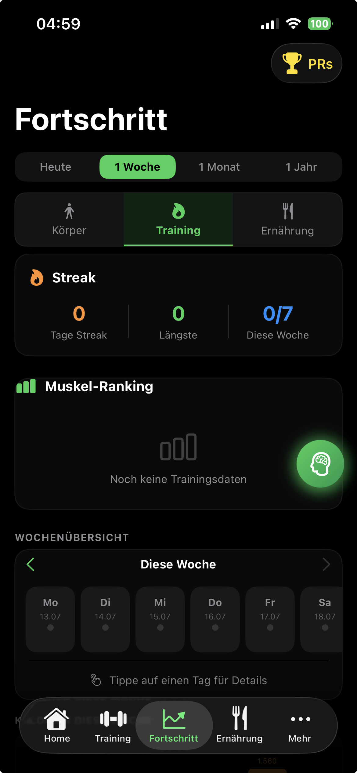 Gym Assist Fortschritt